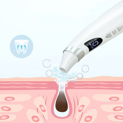 Electric Visual Blackhead Suction Instrument Household Cleansing Pore Cleaner For Skin Equipment Skin Care Tool null