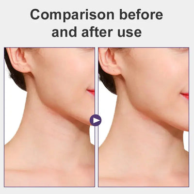 Youthful Glow: Neck Lifting Tape STYLING-YOURSELF Store